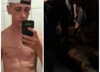 Jovem sofre acidente em Parobé e tem parte da perna amputada
